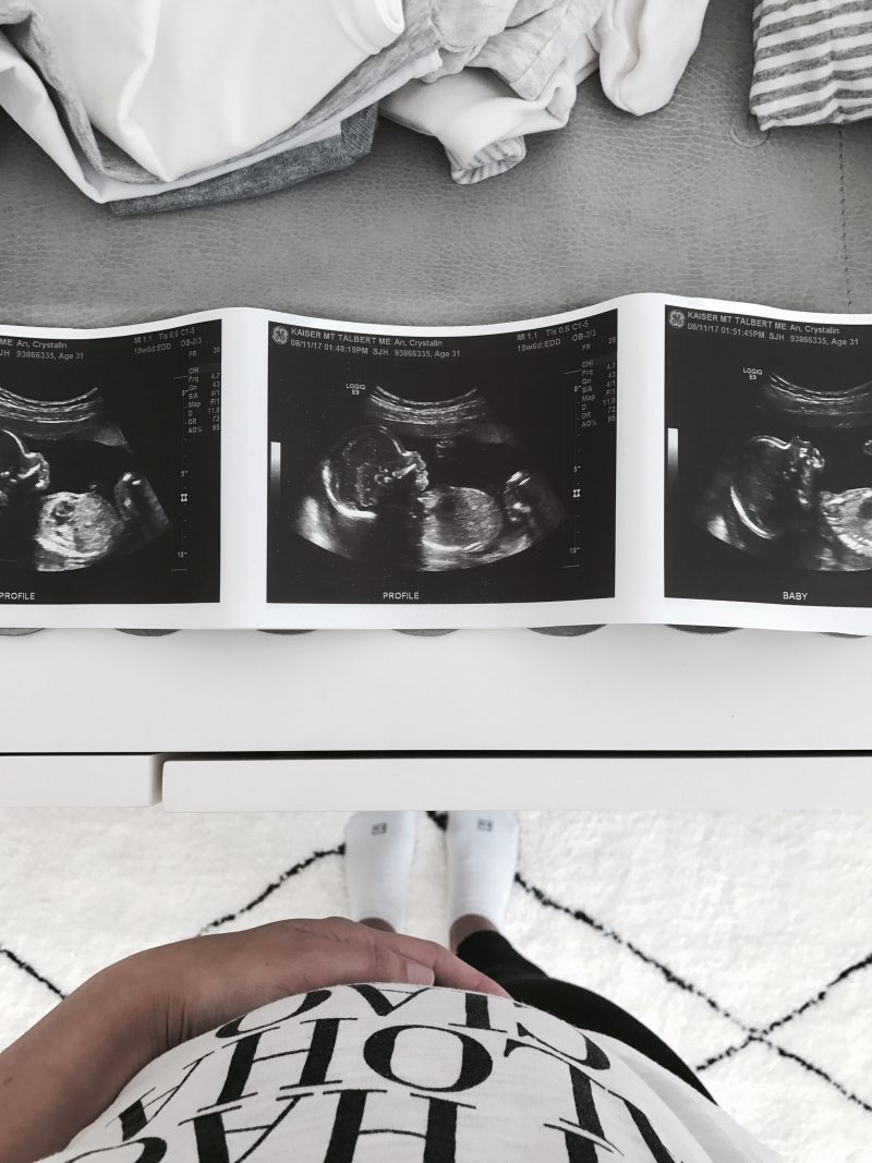 Baby D 20 week ultrasound
